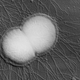 Neisseria gonorrhoeae, the bacteria responsible for gonorrhea. (Image: National Institute of Biomedical Imaging and Bioengineering)